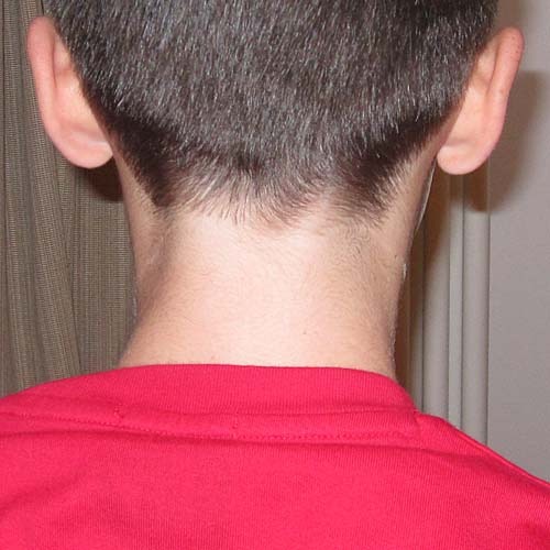 Picture with no-rat tail