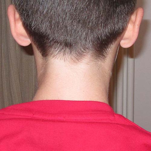 Picture with no-rat tail